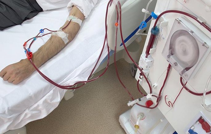 Dialysis
